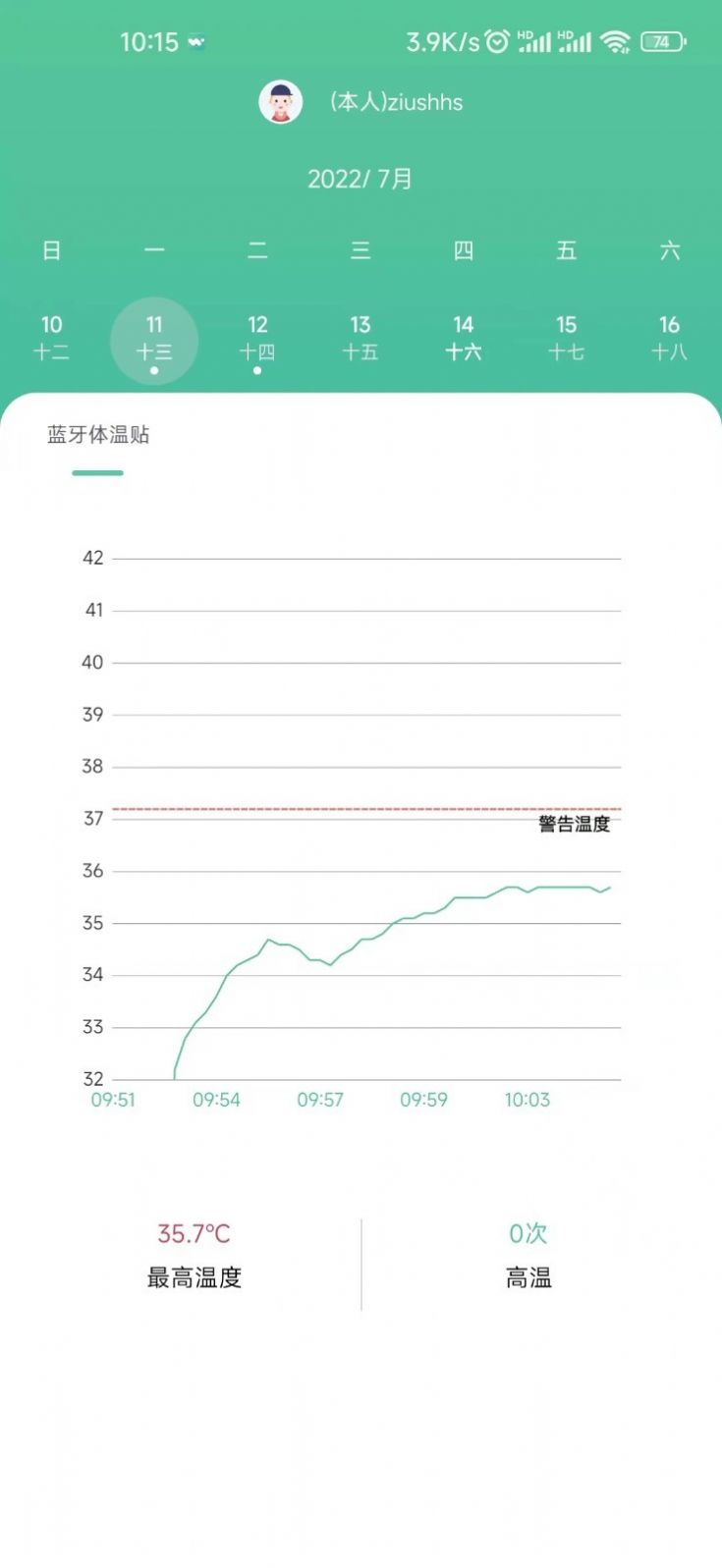 体温监测